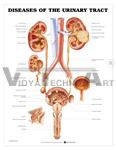 Diseases of the Urinary Tract Anatomical Chart